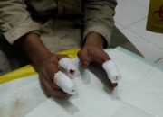 Kecelakaan Kerja Berulang, Bardi Kehilangan Tiga Jari di PT Dexin Steel Indonesia